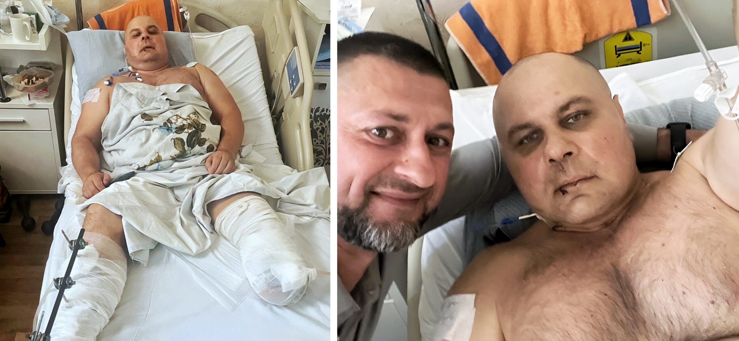 “Після демобілізації обов’язково повернусь на роботу в ліс”, – говорить важкопоранений воїн-лісівник Володимир Домінікін